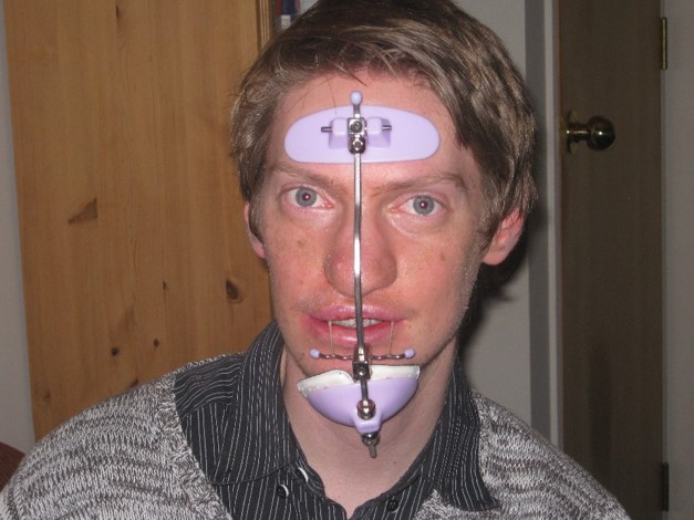 Protraction Facemask